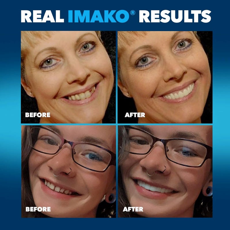 Imako Premium Cosmetic Uppers - 2 Pack - Small, Bleached White - DIY Smile Makeover - Made in USA - Image 5